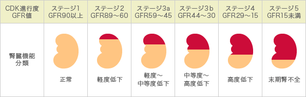 CDK進行度表